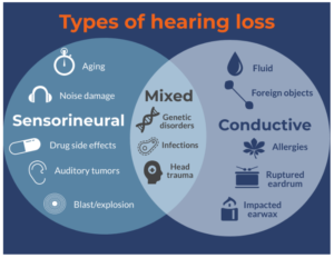 Understanding Hearing Loss